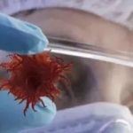 【文獻(xiàn)精度】蛋白組+三代全長(zhǎng)轉(zhuǎn)錄組致力于腫瘤標(biāo)志物的研究