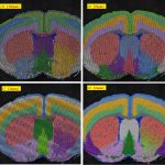 Spatial ATAC 操作指南